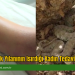 Engerek Yılanının Isırdığı Kadın Tedavi Altında
